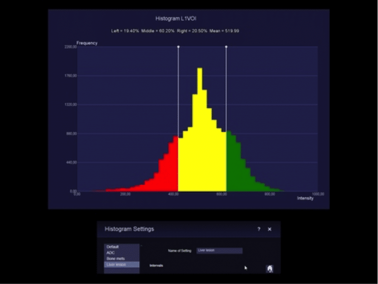 Magnetom-histogram