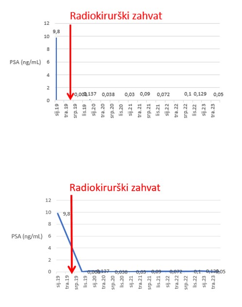 prostata 64 4 