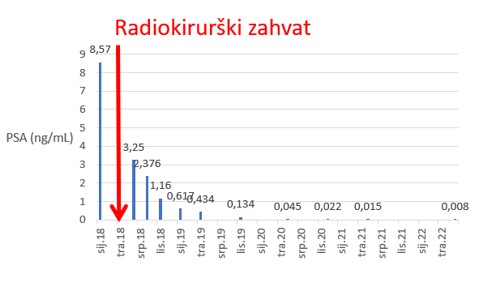 prostata 67 4